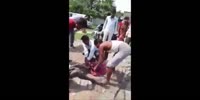 Snake grips man`s leg after the bite
