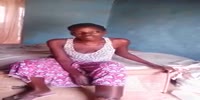 African woman has a terrible leg disaster