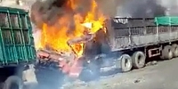 Burnt Trucker Feels the Pain