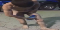 Victim of bath salts shows invisible injures done by space insects