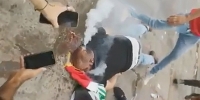 Gas Cylinder Shot INTO Protestor's Head