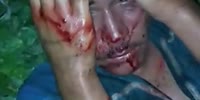 Bleeding thief beaten ruthlessly