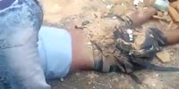 Worker got leg missing