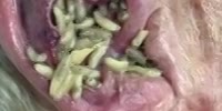 Worms in ear