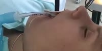 Doctors remove snake who slid in woman’s throat as she slept outdoors in Russia