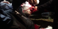 ANTIFA RIOTER BLASTED IN THE HEAD