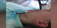 Four Foot Snake Removed From Russian Girl's Throat! (R)
