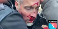 Trump Supporters Attacked By ANTIFA
