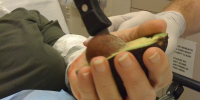 Man accidentally stabs himself trying to remove avocado seed.
