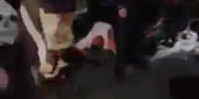 3 bikers injured in accident