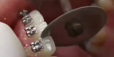 How russians floss their teeth