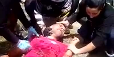 Motorcyclist With Broken Bones Fully Awake