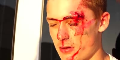 BMXer Discoveres The Pain