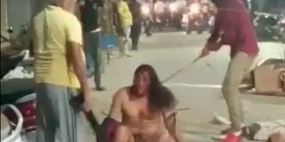 Hairy Man Assaulted Over Rivalry In Delhi