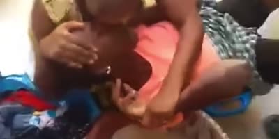 Woman Gets Nose Bitten By Own Sister In Domestic Dispute
