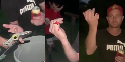 Crazy Drunk Chops Off Finger, Feels Nothing