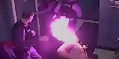 Cops light man's head on fire