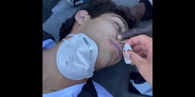 Dude Saves Overdosed On Fentanyl Junkie In San Francisco