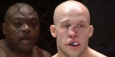 MMA fFghter Blake Perry Tries To Keep Fghting With Nose Broken