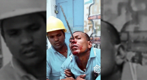 Construction Site Worker Survives Impalment In Maldives