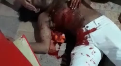 Death agony after stabbing