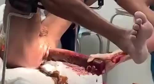WTF: The Things Surgeons Have to Deal With