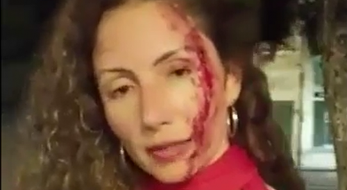 Female Reporter Attacked Over Newly Elected President Sticker