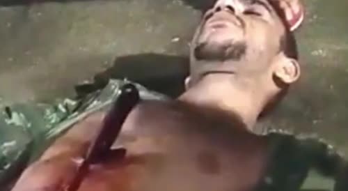 The last minutes of a stabbed man in Brazil