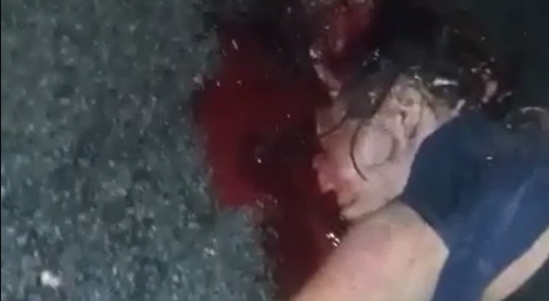 Rather Gruesome Aftermath Of Hit & Run In Brazil