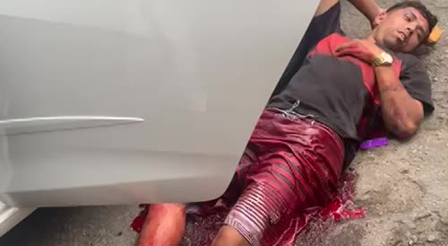 Car Thief Shot In The Ass By Police In Brazil