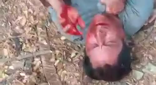 Bleeding Thief Begs For Mercy In Colombia