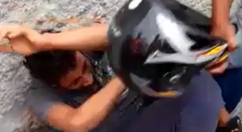 Failed Thief Bashed Gets Helmet Therapy