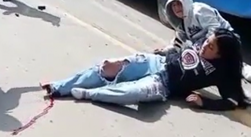 Girl Loses Foot In Motorcycle Accident In Bogota, Colombia