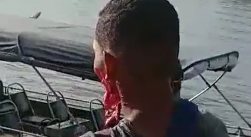Boat Thief Stabbed In The Face During Citizens Arrest