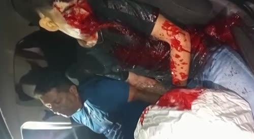Guy bleeds out profusely after car wreck.