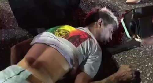 Delivery Guy Convulses Following Accident In Brazil