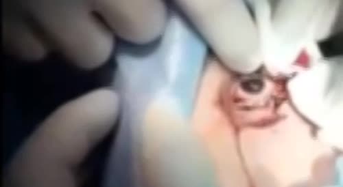 Woman got stabbed in the eye(repost)