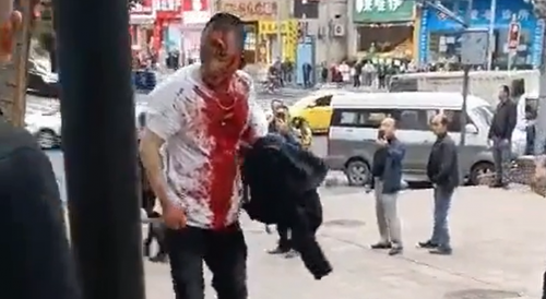 Man Stabbed In The Neck During Fight In China
