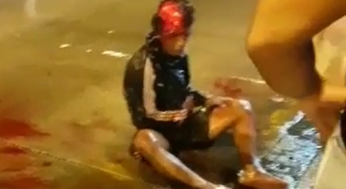 Scalped man suffers in the rain