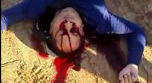 Municipal Guard of itapororoca(Brazil) Shot In The Eye By Thieves