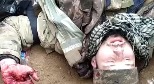 Interrogation of a captured, wounded Ukrainian militant