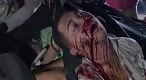 A VIOLENT ACCIDENT IN GUATEMALA