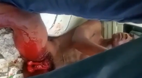 WTF? Dude Cuts Dick off After Girlfriend Breaks Up With Him
