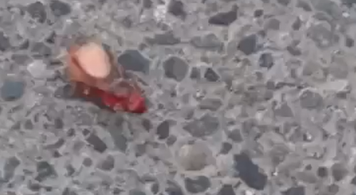 Man Loses Finger In Machete Fight