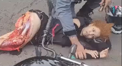 Girl Fully Awake After Surviving Gruesome Bike Crash