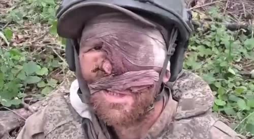 Tourist from the swamps captured with damaged face