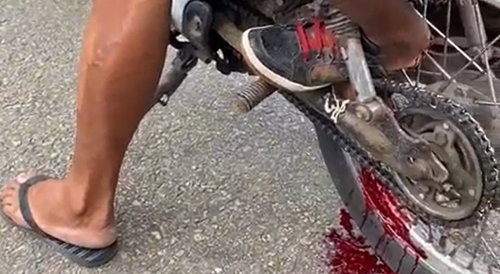 Elderly Rider Made One Mistake