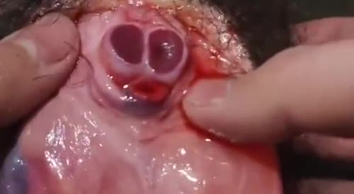Penis Mutilation Porn - Graphic Videos - Uncensored reality documented by you !