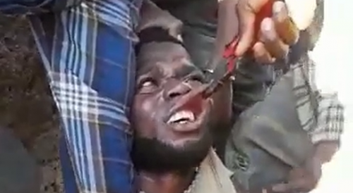 Tanzanian Thief Tortured With Pliers