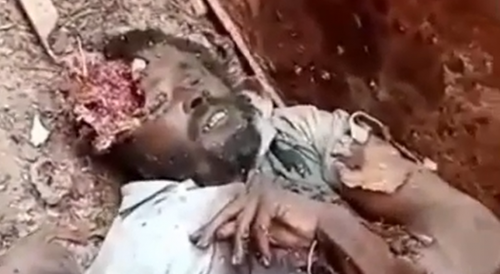 Ethiopian Soldier Shows Civilan He Shot In The Head Minutes Before